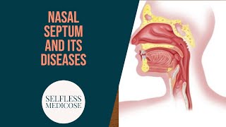 NASAL SEPTUM and DISEASES part 2 DEVIATED NASAL SEPTUM [upl. by Cirdes343]