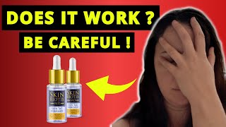 SKIN BIOTIX MD SKIN TAG REMOVER REVIEWS ❌NEW ALERT❌ Skin Biotix Skin Tag Remover Review [upl. by Hunger]