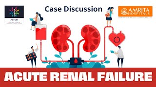 Acute Kidney Injury  Case Discussion  Indications for dialysis [upl. by Ppik]