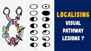 LESIONS OF VISUAL PATHWAY  SCOTOMAS EXPLAINED Junctional scotoma HOMONYMOUS HEMIANOPIA [upl. by Ennoid426]