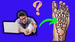 How to tell if you MIGHT have a LISFRANC INJURY [upl. by Nosauq547]