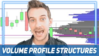 Volume Profile 7 Intraday Structures You need to know [upl. by Dumas389]