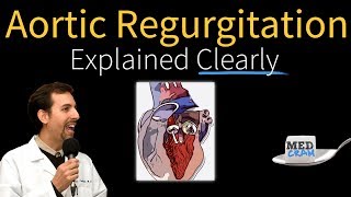 Aortic Regurgitation Insufficiency Explained Clearly [upl. by Nosinned]