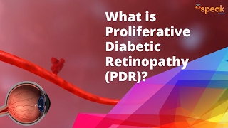 What is Proliferative Diabetic Retinopathy PDR [upl. by Krusche]