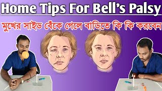 মুখ বেঁকে গেলে করনীয় কি কি  Facial Palsy Treatment in Bangla  Bell’s Palsy [upl. by Panta366]