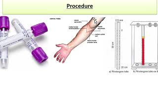 ESR  Erythrocyte sedimentation rate  Physio lab practical  urduhindi [upl. by Olenka]