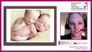 Double Trouble Imaging Twins for the Community Sonographer  Dr Stephanie Cooper  AFIC [upl. by Ovida547]