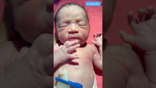 After birth Respiratory Distress medical newbornbaby viralvideo [upl. by Nospmoht218]