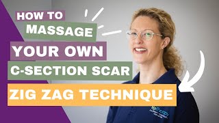 Scar Therapy  Techniques  Zig Zags  CSection Scarring and Recovery with HLP Therapy [upl. by Redman]