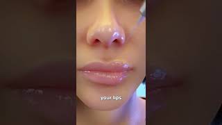 How Lip Fillers Work lips filler lipfiller [upl. by Nosnevets802]