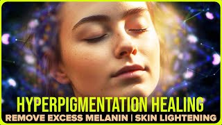 Binaural Beats for AntiAging and Skin Lightening Hyperpigmentation Healing Frequency Subliminal [upl. by Notneuq]