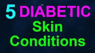 INTERVIEW 5 Diabetic Skin Conditions with Dr Saini of MD Dermatology [upl. by Cheke]