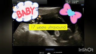 17 weeks pregnant baby girl ultrasound [upl. by Sana]