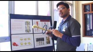 Distraction osteogenesis Process [upl. by Ofella]