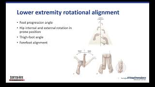 Lower Extremity Alignment [upl. by Clotilda]