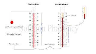 ESR Test  Erythrocyte Sedimentation Rate  ESR Determination  Erythrocyte Sedimentation Test [upl. by Thunell]