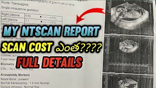 MY NT SCAN REPORT FULL DETAILS HOW MUCH COST IN TELUGU [upl. by Notlrak]