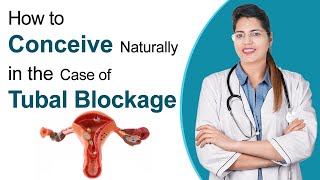 Best Way to Get Pregnant with Blocked Fallopian Tube  How to Unblock Fallopian Tubes  Dr Chanchal [upl. by Hesky]