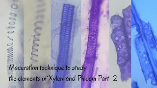 Maceration Technique to Study the Elements of Xylem amp Phloem Part2 [upl. by Klecka]