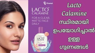 Lacto Calamine Face Lotion  Oil Control Face Cream For Daily Use  Paraben Free Formula [upl. by Lohse]