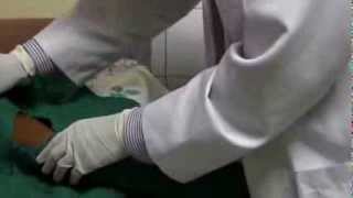 Contraceptive Implants  09  Procedure Place fenestrated towel over arm [upl. by Storm313]