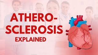 Atherosclerosis Explained [upl. by Laamak475]