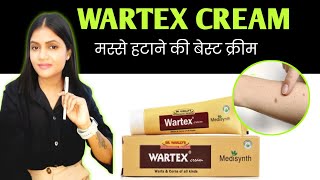 मस्से सूखकर झड़ जायेगे  मस्से हटाने की सबसे असरदार क्रीम  wartex Cream uses in hindi [upl. by Erdnad]