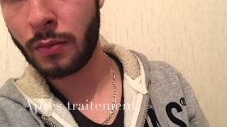 Faire pousser sa barbe avec Beardilizer [upl. by Eyar]