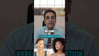 Melasma vs Hyperpigmentation Whats the Difference amp How to Treat Them [upl. by Pattie]