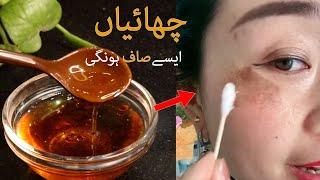 How to remove freckles on face  چھائیاں ایسے صاف ہونگی [upl. by Thia]