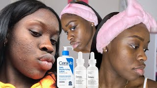 HOW TO CLEAR TEXTURED SKIN  My Fungal Acne Skincare Routine  The Ordinary Curology amp Cerave [upl. by Eemiaj]