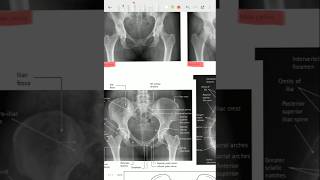 Pelvis Xray xray xraytechnician dritbritpelvisxray trending viralvideo [upl. by Son]