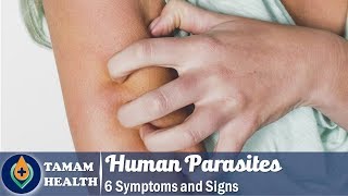 6 Symptoms of Human Parasites Everyone Should Know [upl. by Aissilem]