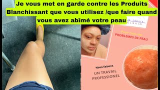 JE VOUS METS EN GARDE CONTRE LES PRODUITS BLANCHISSANTS QUI BRÛLENT VOS PEAUX MESDAMES QUE FAIRE SI [upl. by Ynaiffit971]