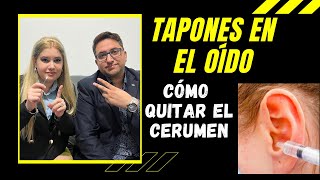 Lavado de oídos  Cuidado Auditivo  Procedimiento de lavado de oídos  Cómo quitar el cerumen oído [upl. by Rector]