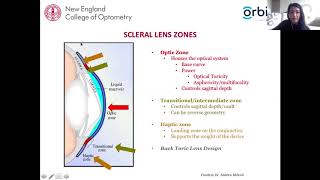 Scleral Lens Assessment and Fitting [upl. by Lowry]