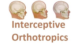 Correcting the Growth of Upper Jaw with Interceptive Orthotropics by Prof John Mew [upl. by Chee]