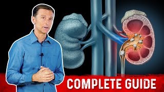 Kidney Stones 101 Causes Symptoms amp Remedies – DrBerg [upl. by Sklar773]