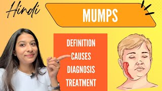 Mumps  Symptoms diagnosis Treatment  Explained easily in Hindi [upl. by Tegdirb]