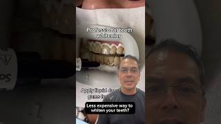 Professional Teeth Whitening vs Hydrogen Peroxide EXPLAINED  In Office to Hands On Dental Training [upl. by Kerwin605]