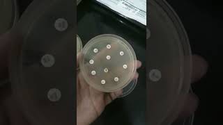 lawn culture antibiotic sensitivity test medical medico microbiology [upl. by Notslah979]