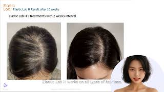 Elastic Lab H Innovative Hairbooster [upl. by Nylg9]