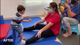 Physical Therapy for Children  Conditions amp Improvements Before amp After Therapy [upl. by Nalyk77]