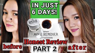 Organica Mole RemoverHonest Review Part 2 [upl. by Sarnoff]