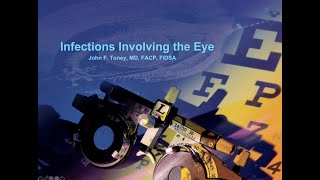 Infections of the Eye Part I  John Toney MD [upl. by Nosraep]