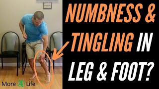 Numbness and Tingling In Leg and Foot [upl. by Beattie25]