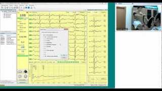 Основы ЭКГ вебинар ч2 [upl. by Crawley]
