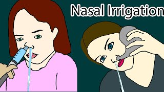 Nasal Irrigation  how to do nasal irrigation Nasal Rinse [upl. by Gaylene301]