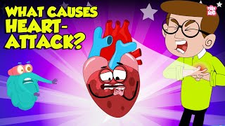 What Causes Heart Attack  How to Keep Your Heart Healthy  Heart Attack Signs and Symptoms [upl. by Latterll]