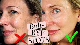 How To Get Rid of Age Spots [upl. by Cathy]